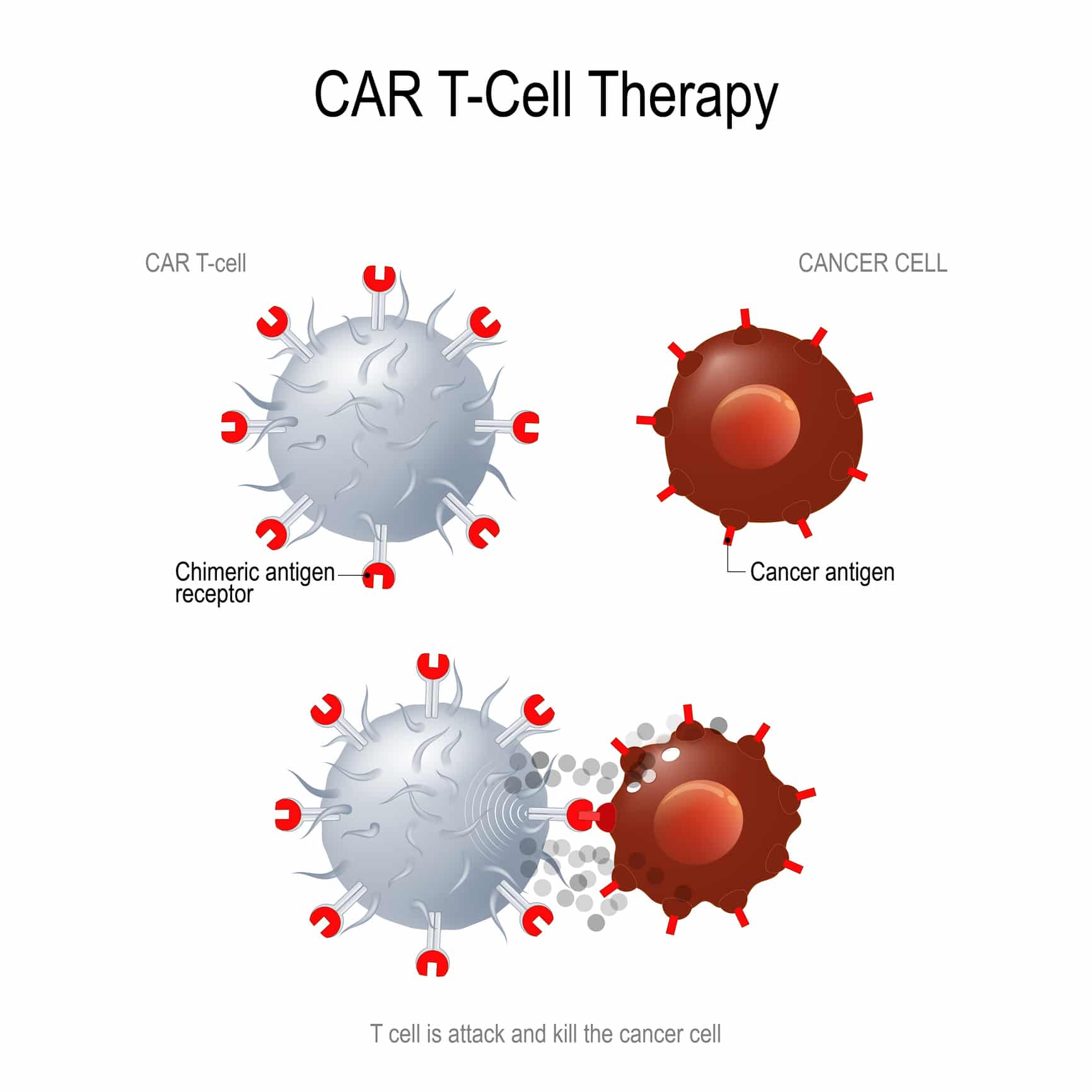 Read more about the article CAR-T Tx Shifts into First Gear in Lung Cancer